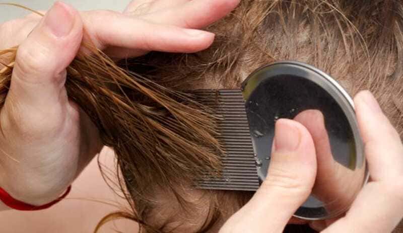 How to remove and avoid head lice.